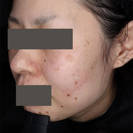 Before image