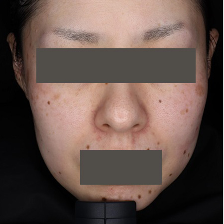 Before image