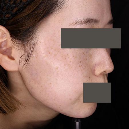 Before image