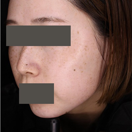 Before image