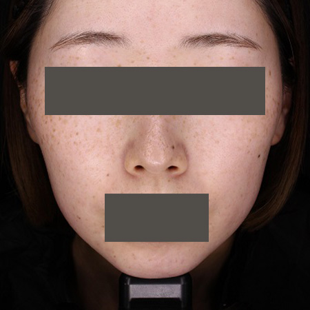 Before image
