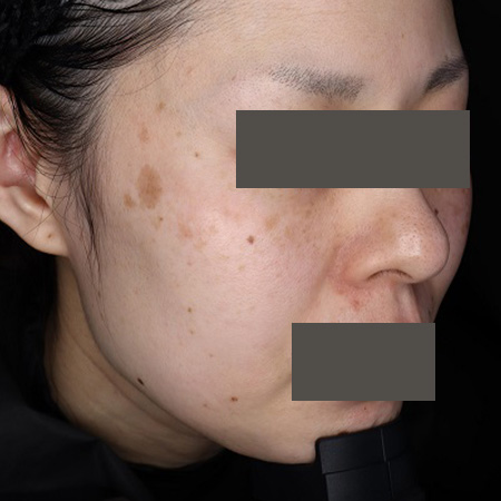 Before image