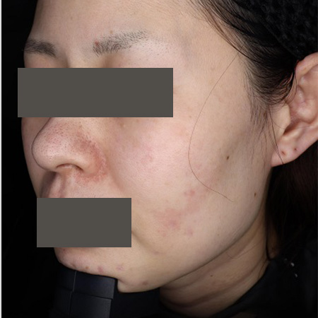 After image