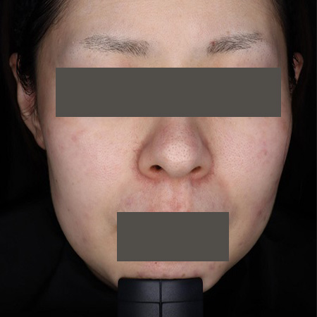 After image