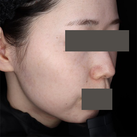 After image