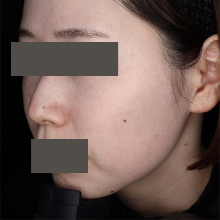 After image
