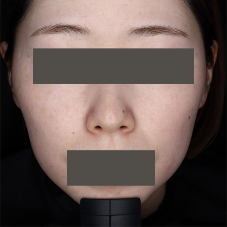 After image