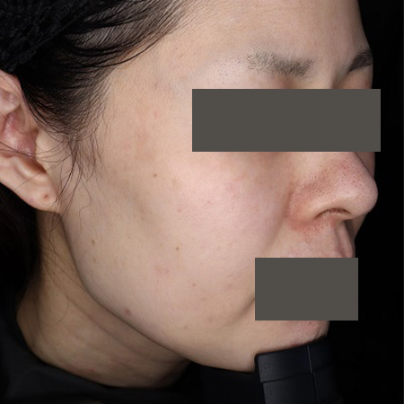 After image