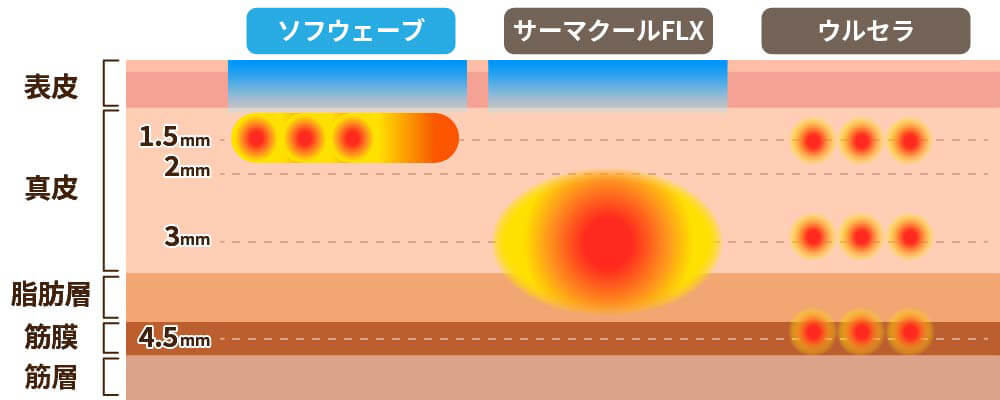 ソフウェーブの優位性